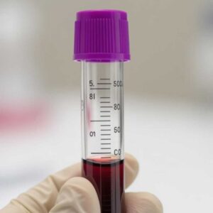 خون کنترل - STARLAB