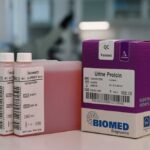 urine protein