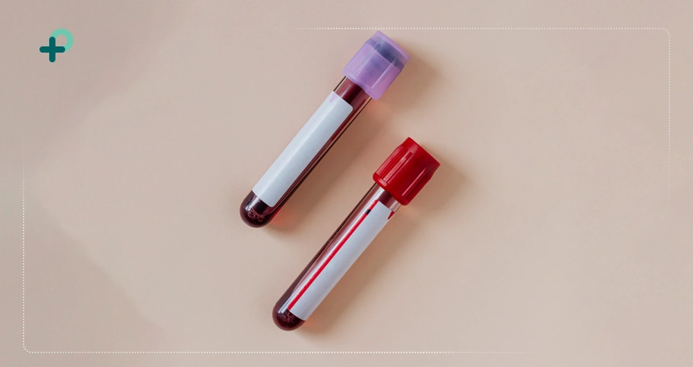 آشنایی با لوله‌ وکیوم خون