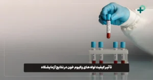 تاثیر لوله وکیوم خون در نتایج آزمایشگاه