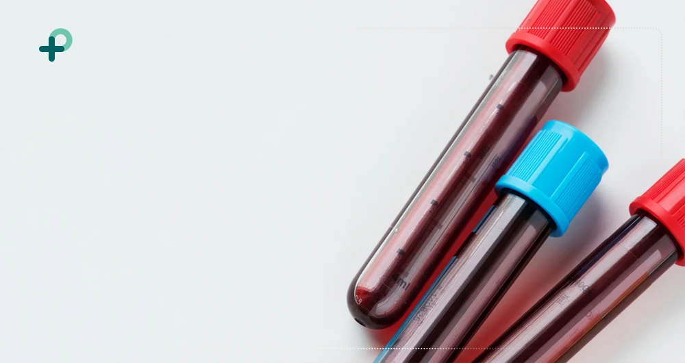 تاثیر لوله وکیوم خون بر کیفیت نتایج