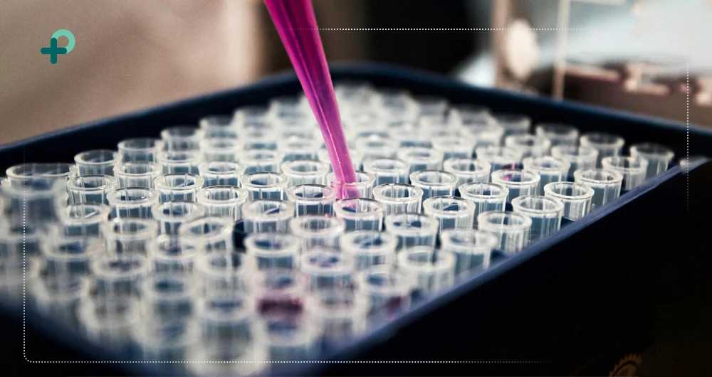 محتویات کیت CRP بایومد