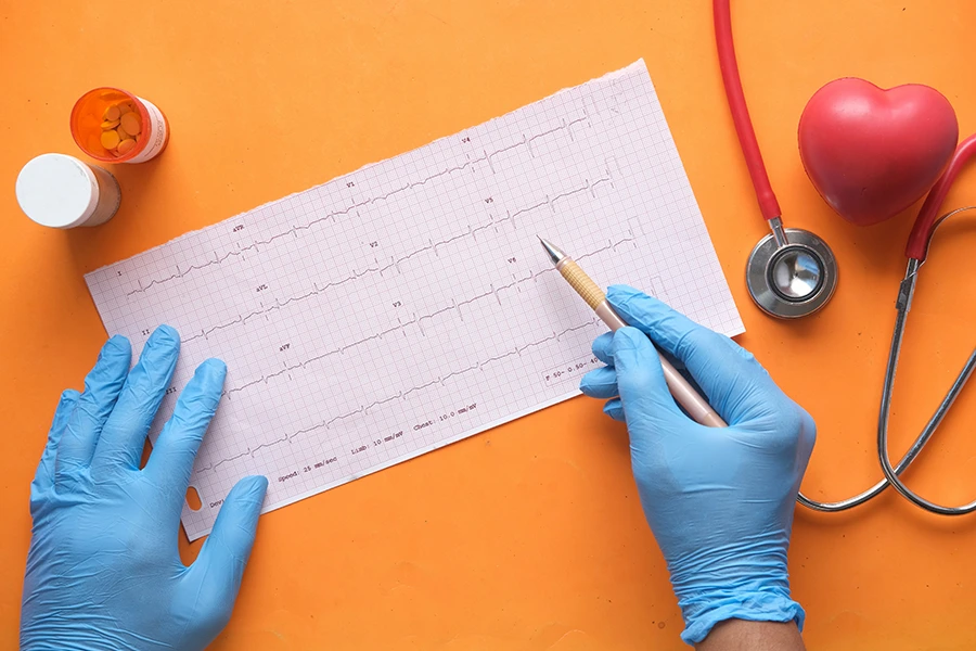 نوار قلب (الکتروکاردیوگرافی - ECG)